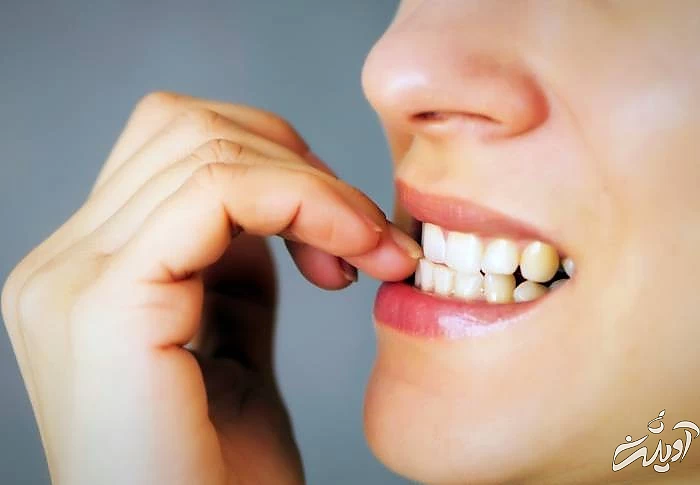 جویدن ناخن